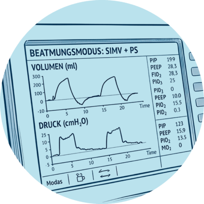 Display eines Beatmungsgeräts mit Anzeige des Beatmungsmodus SIMV und Druck- sowie Volumenkurven.