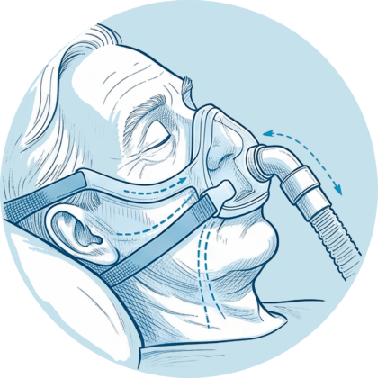 Älterer Mann mit CPAP-Mund-Nasen-Maske zur Schienung der Atemwege mit Luftstrom-Pfeilen.