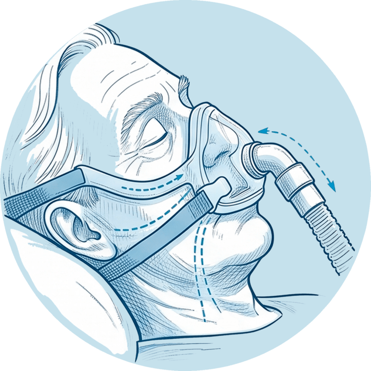 Älterer Mann mit CPAP-Mund-Nasen-Maske zur Schienung der Atemwege mit Luftstrom-Pfeilen.