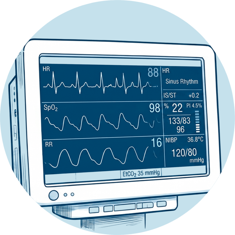 Medizinischer Patientenmonitor mit Anzeigewerten für EKG, Sauerstoffsättigung und Blutdruck.