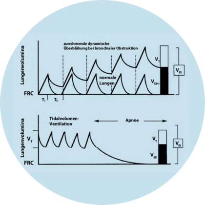 Diagramm zur Darstellung von Lungenvolumina und Atemzugvolumen bei maschineller Beatmung.