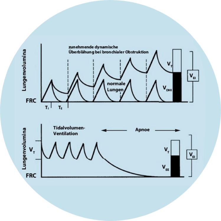 Diagramm zur Darstellung von Lungenvolumina und Atemzugvolumen bei maschineller Beatmung.